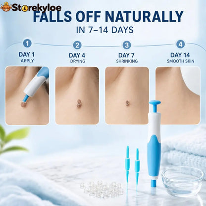 🧴 Natural Skin Tag Remover Kit