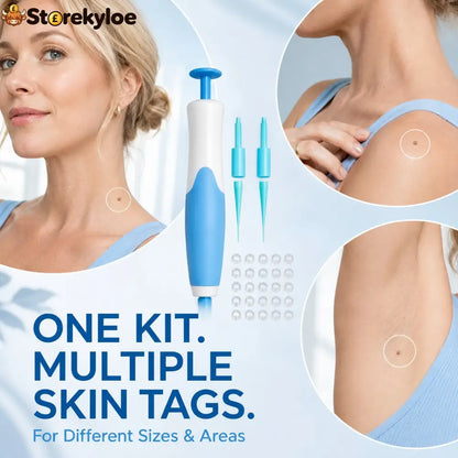 🧴 Natural Skin Tag Remover Kit