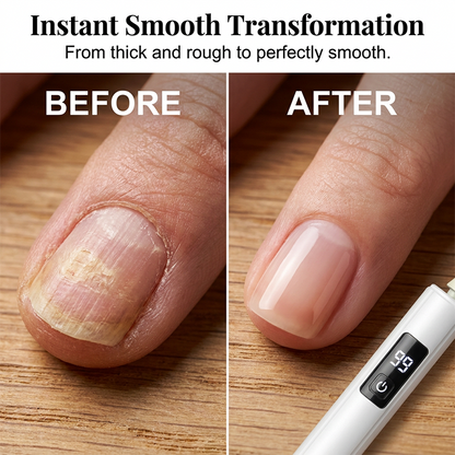 💅✨  Professional Electric Nail Polisher – Smooths thick nails, 99-speed display. Multiple heads for shaping & buffing. Salon at home!